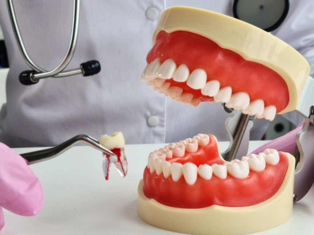 Orthodontic Braces