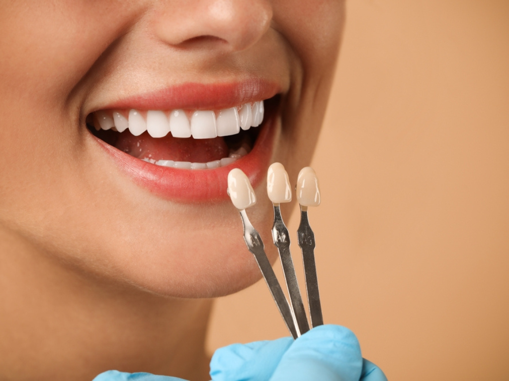 Orthodontic Braces