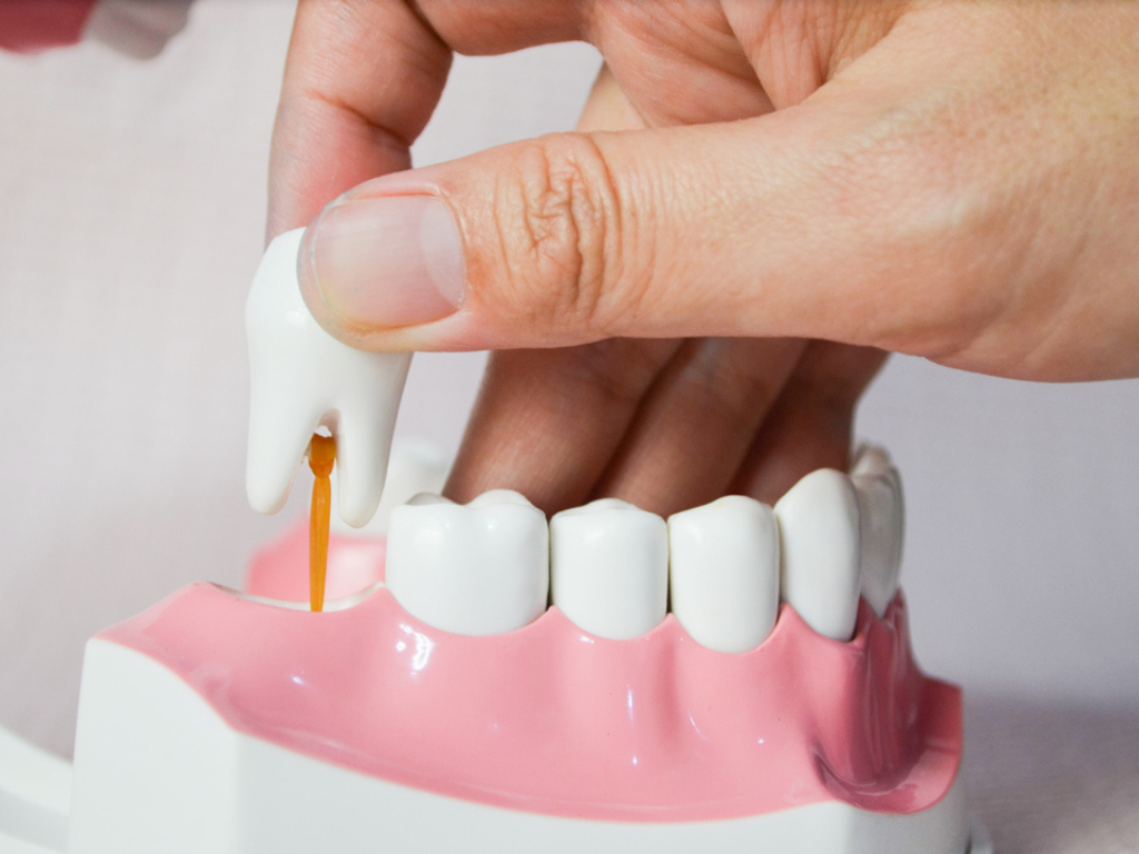 Orthodontic Braces