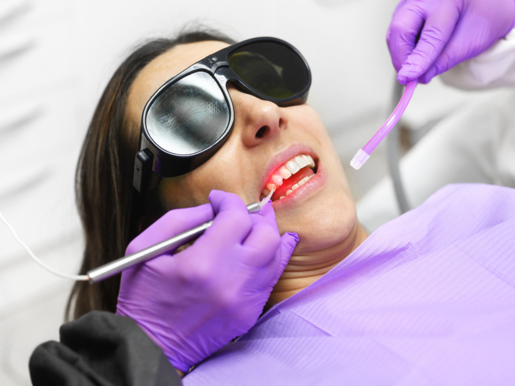 Orthodontic Braces